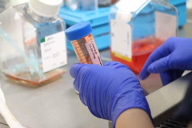 KANSER TERAPİLERİNİN KATI TÜMÖRLERDEKİ ETKİSİ ARAŞTIRILIYOR