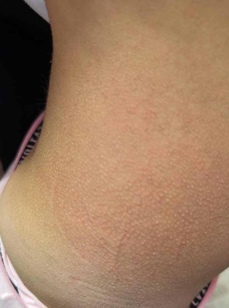 KIZIL VAKALARI ARTTI