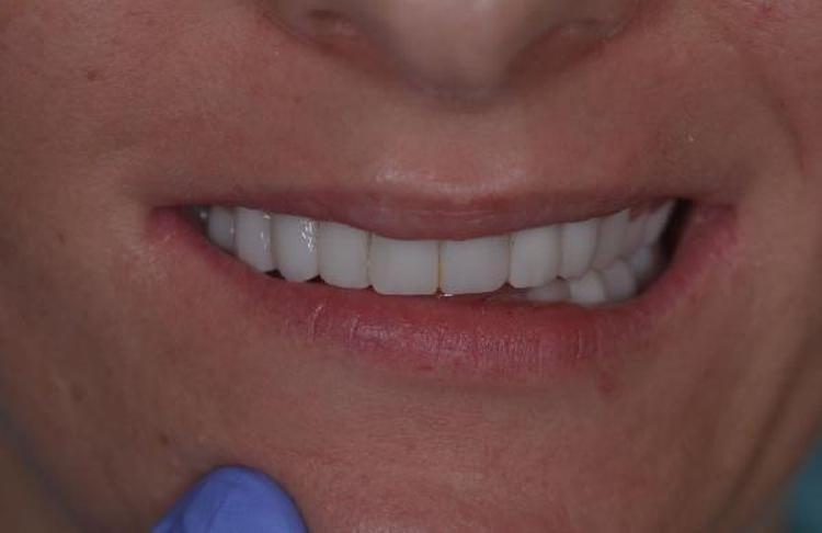 ŞU ANDA DAVA AŞAMASINA HAZIRLANIYORUZ