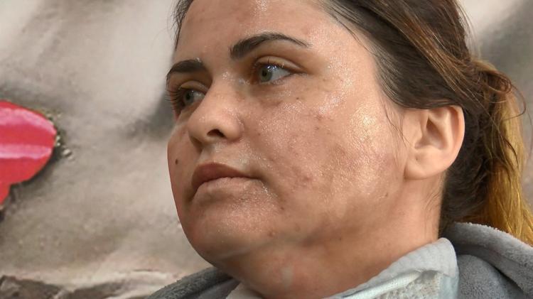 BİR PSİKOPAT YÜZÜNDEN İSMİMİ YÜZÜMÜ MÜ DEĞİŞTİRECEĞİM