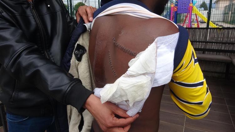 GÖZÜMÜ AÇTIĞIMDA HASTANEDEYDİM