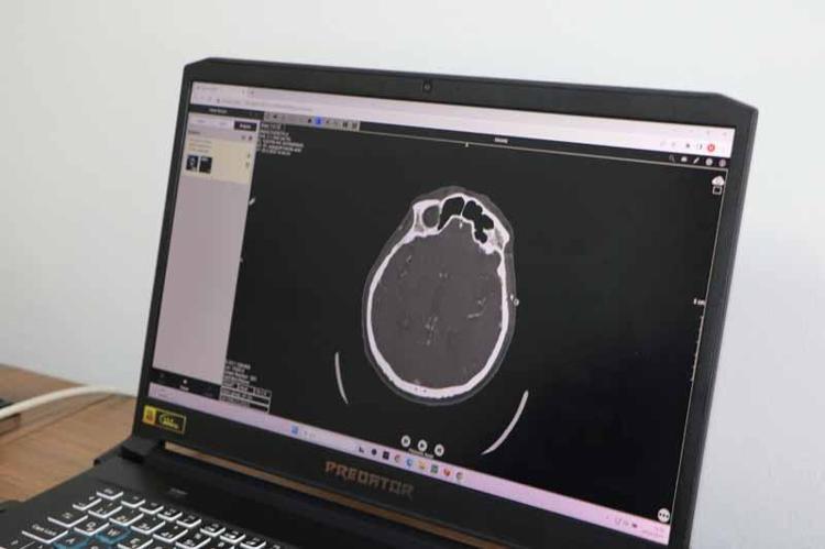 HASTALIK TANISINA YARDIMCI