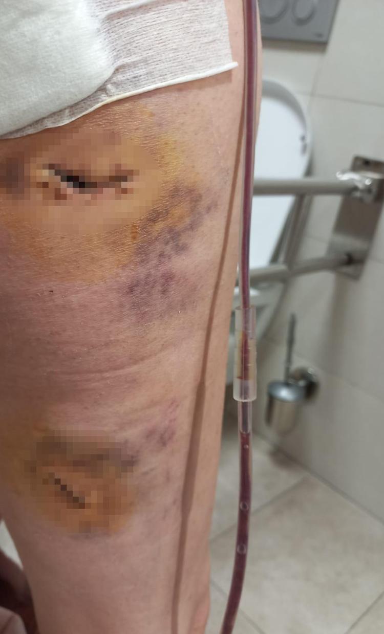 ‘HAKARETTE BULUNUNCA BIÇAĞI RASTGELE SALLADIM’