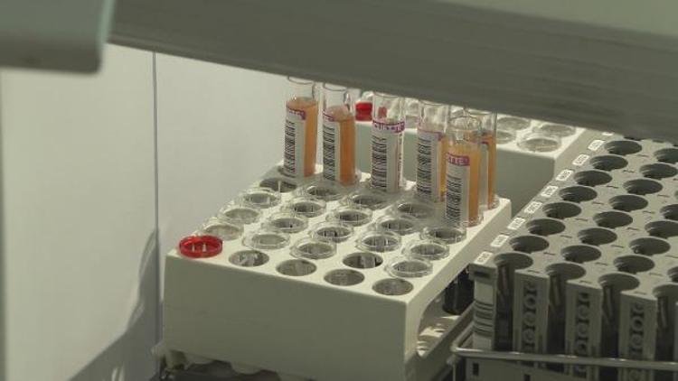 “HERKESİ KAN BAĞIŞINA DAVET EDİYORUZ