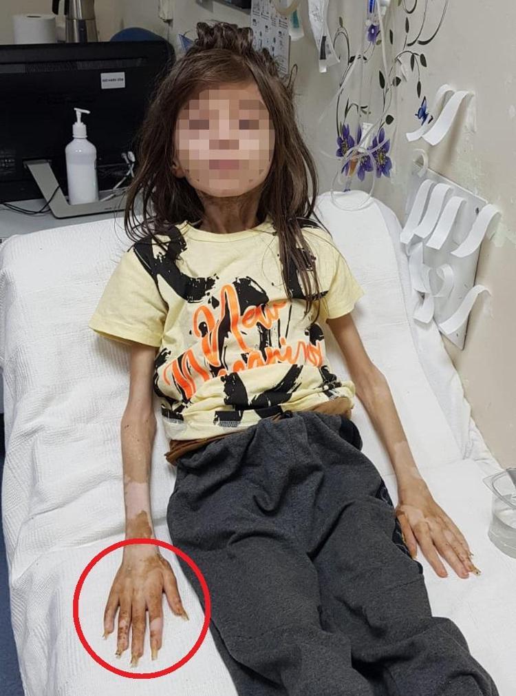 TEYZE TUTUKLANDI, YEĞEN KORUMA ALTINDA