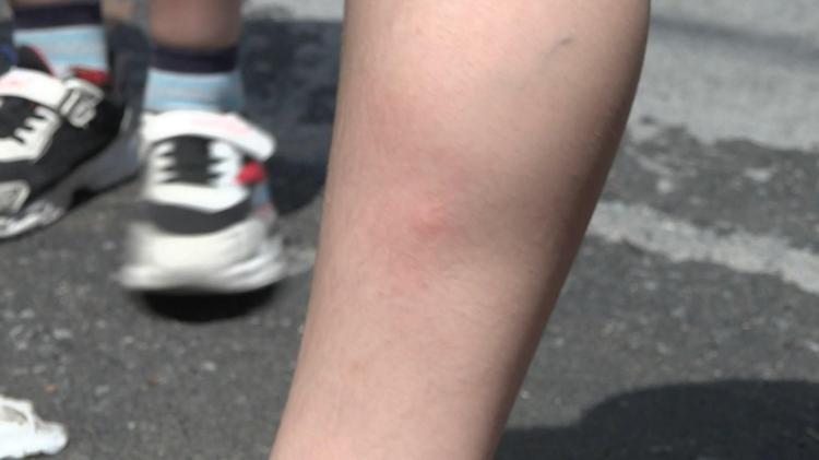 ÖZELLİKLE SON DÖNEMDEKİ SİVRİSİNEKLERİN CİNSLERİ FARKLI