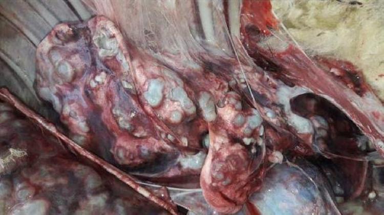 SAFRA KESESİ KANALINI TIKAYABİLİR