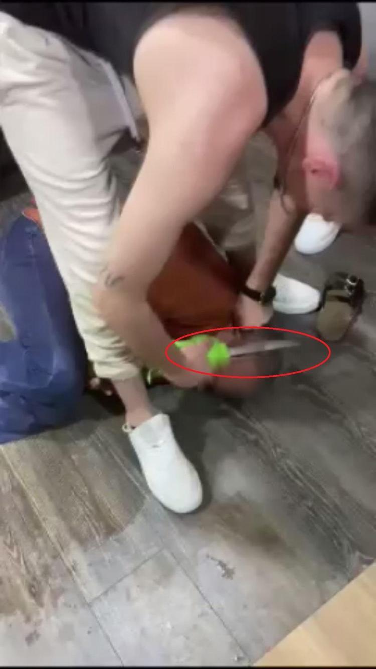 DARBELERDEN DOLAYI BİR AYAĞIM TUTMUYOR