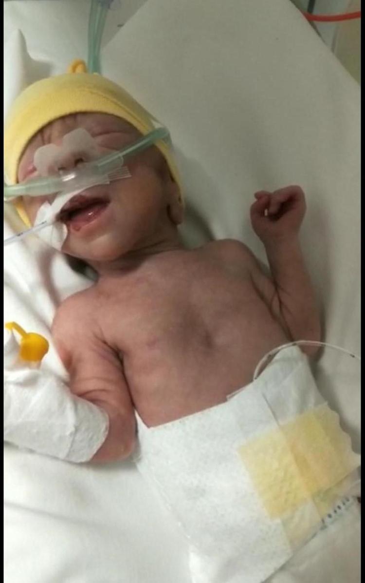 ANNESİ İLK KEZ 4 AY SONRA KUCAĞINA ALABİLDİ