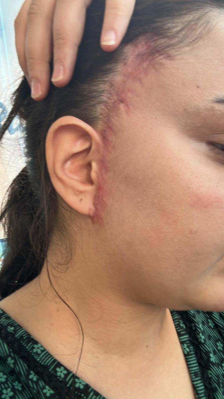 İYİLEŞMEYEN YARALARIM VAR