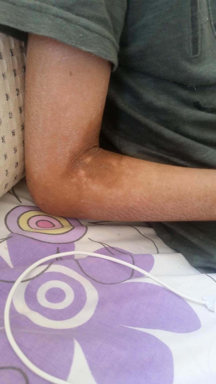 KAYRANIN BAKIM PARASI KESİLDİ