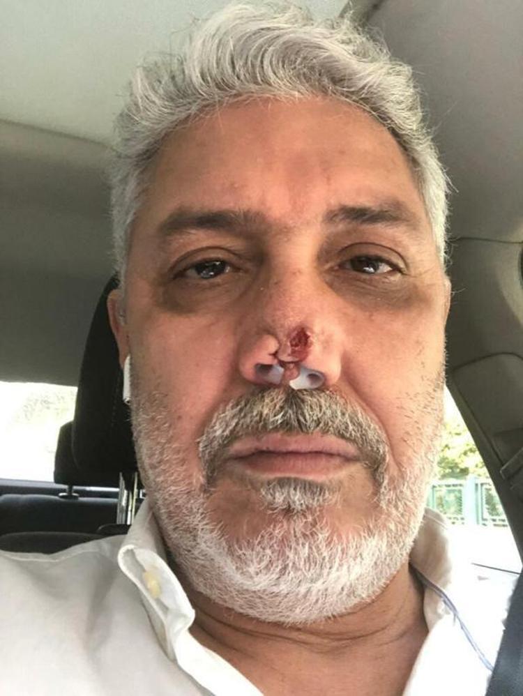 BURNUM FONKSİYONLARINI YERİNE GETİREMİYOR