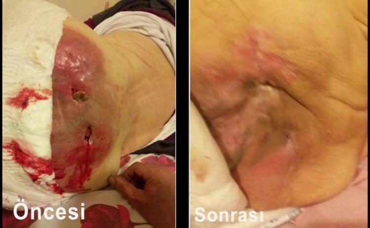 YAKLAŞIK 14 YIL SÜRDÜ