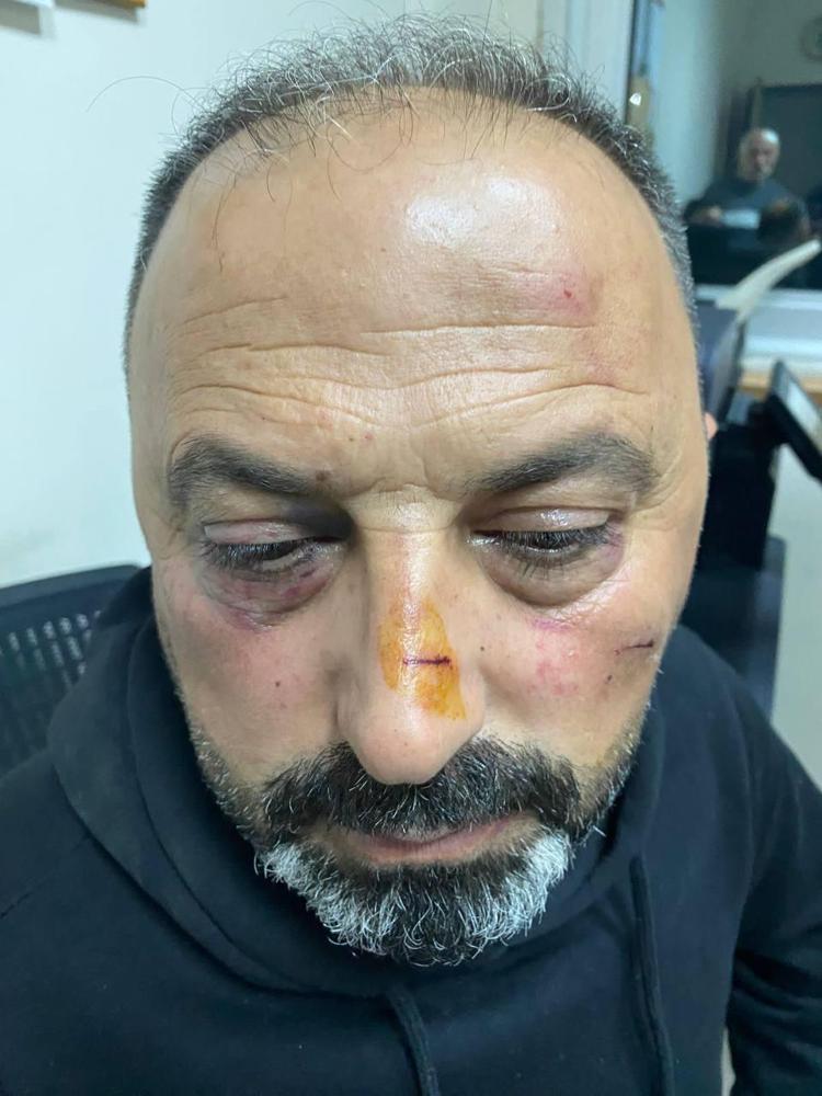 ‘SOPA VE MUŞTAYLA VURUYORLARDI