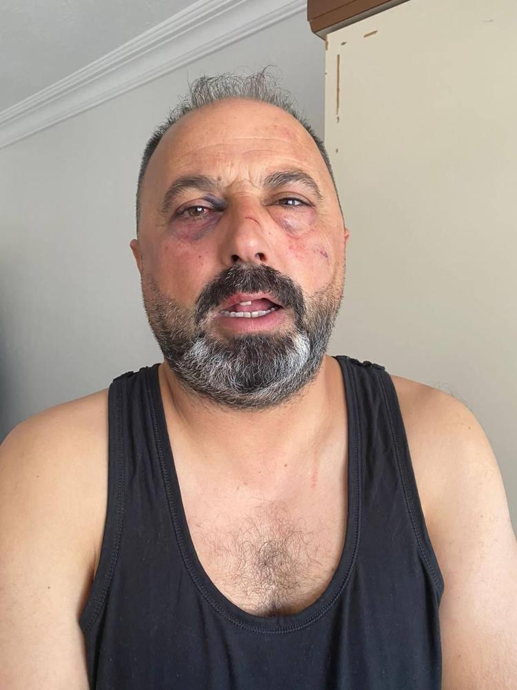 KAVGANIN NEDENİ BORÇ MESELESİ İDDİASI