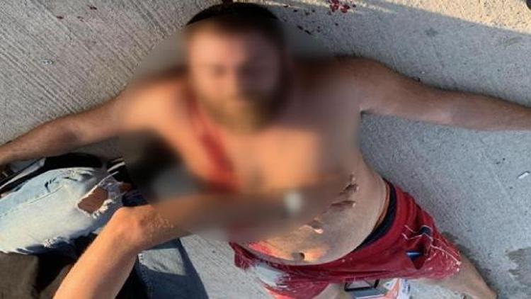 ALPER VURULDUM ABİ DEYİP SIRT ÜSTÜ GERİYE DÜŞTÜ