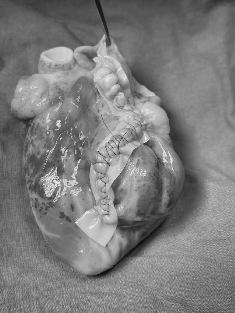 “EN UFAK BİR HATADA BAŞKA ALTERNATİFİMİZ YOKTU