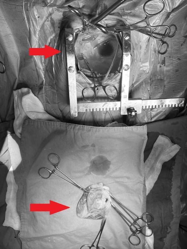 “BİRİLERİ RİSK ALMALI DEDİ VE ONU KURTARDI