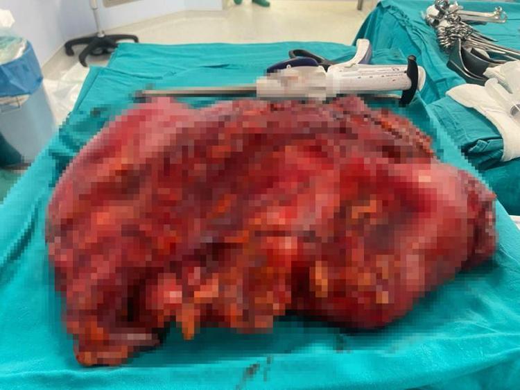 8 KİLO AĞIRLIĞINDA OLDUĞUNU GÖRDÜK