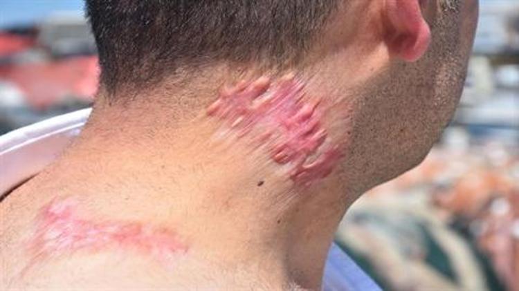 PSİKOLOJİK SORUNLAR YAŞIYORUM