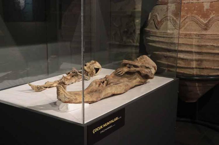 BİR CİSİMLE BOĞULDUĞUNU VÜCUDUNDAKİ İZLERDEN ANLAMAKTAYIZ