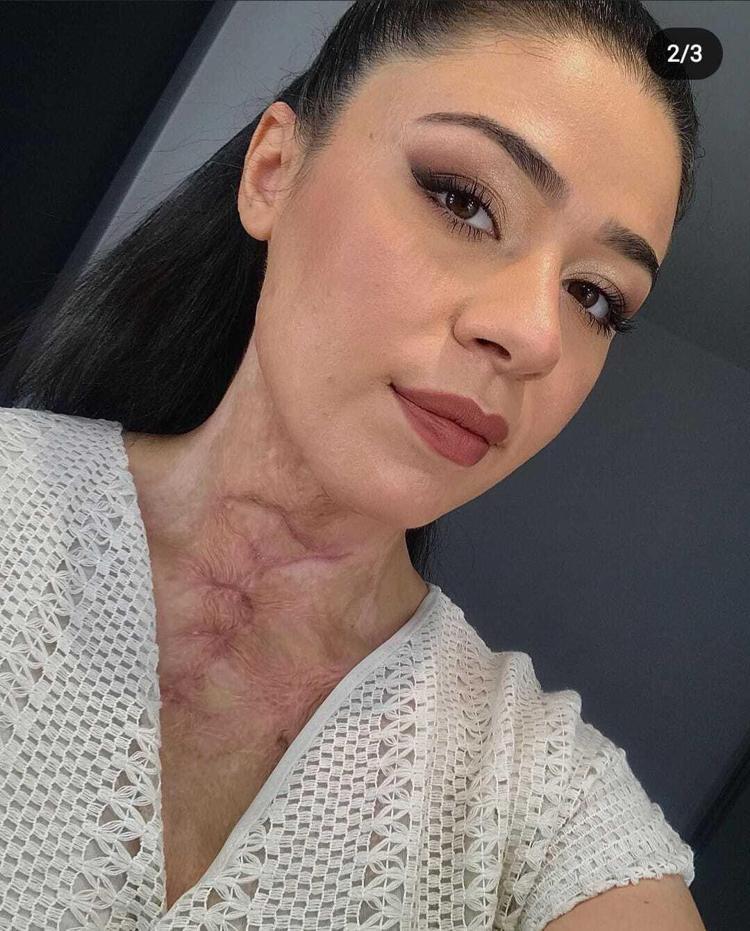 ‘YANIKLARIMIN DIŞINDA ÇOK ACILAR ÇEKTİM’