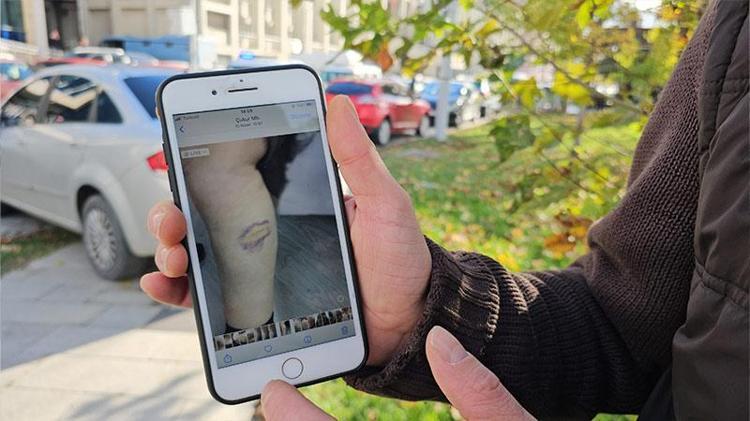 ANNESİNİN GÖZLERİ GÖRMEMEKTEDİR