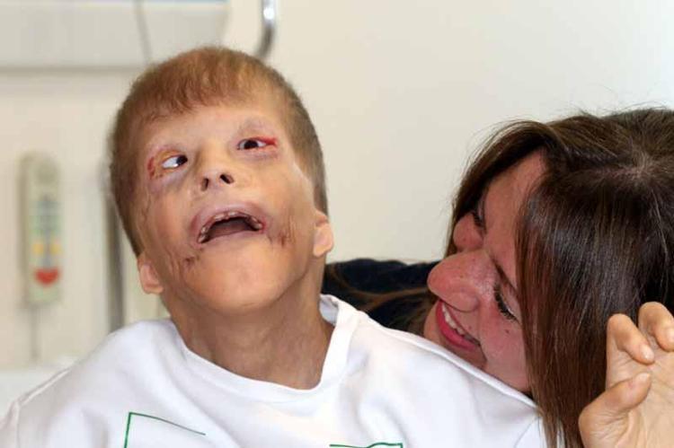 BU OPERASYONLAR DIŞ GÖRÜNÜŞÜNÜ OLUMLU YÖNDE DEĞİŞTİRDİ