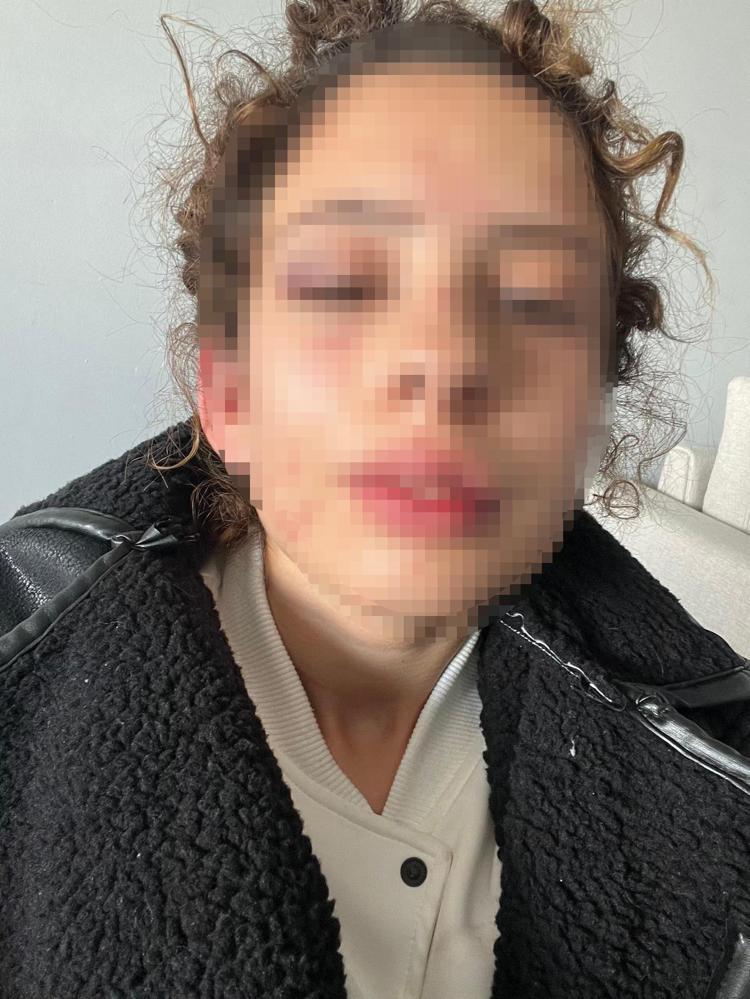 ADLİ KONTROLLE SALIVERİLDİLER