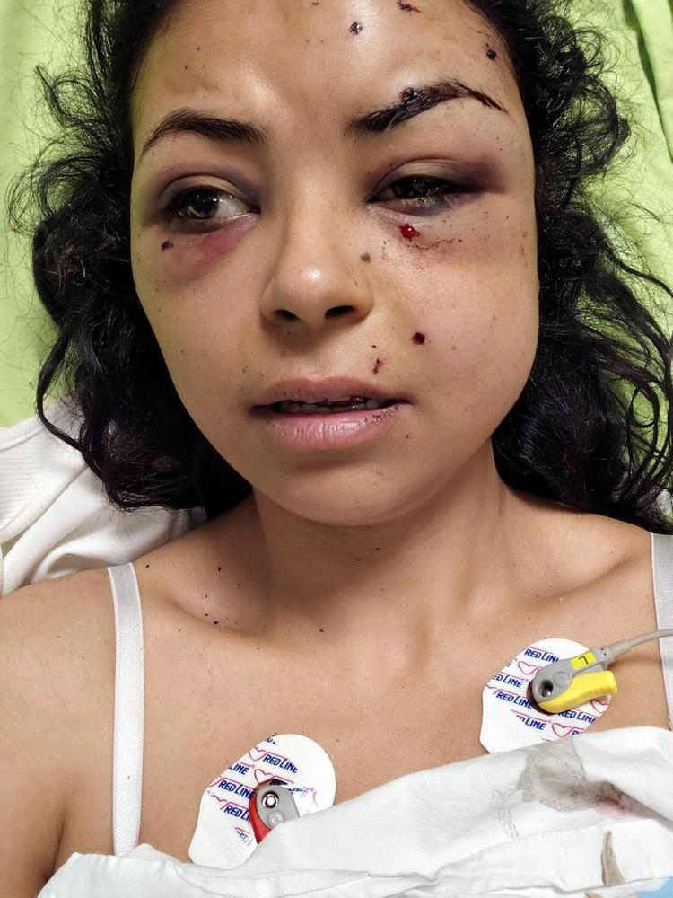 GÖZÜMÜ HASTANEDE AÇTIM