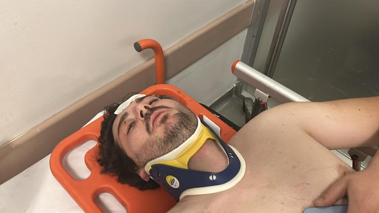 YÜZÜME, HER YERİME VURMAYA BAŞLADI