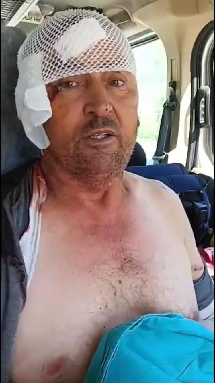 ASLAN TÜFEKLE ÖLDÜRÜLDÜ