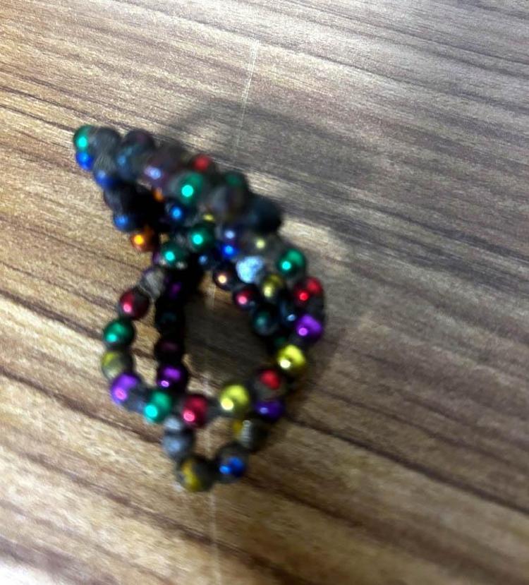 MİDE VE BAĞIRSAKLARINDA AYLARCA YAPIŞIP KALMIŞ