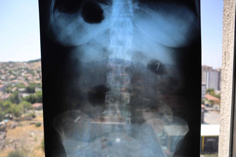 KİMSE O RİSKİ ALMAK İSTEMİYOR