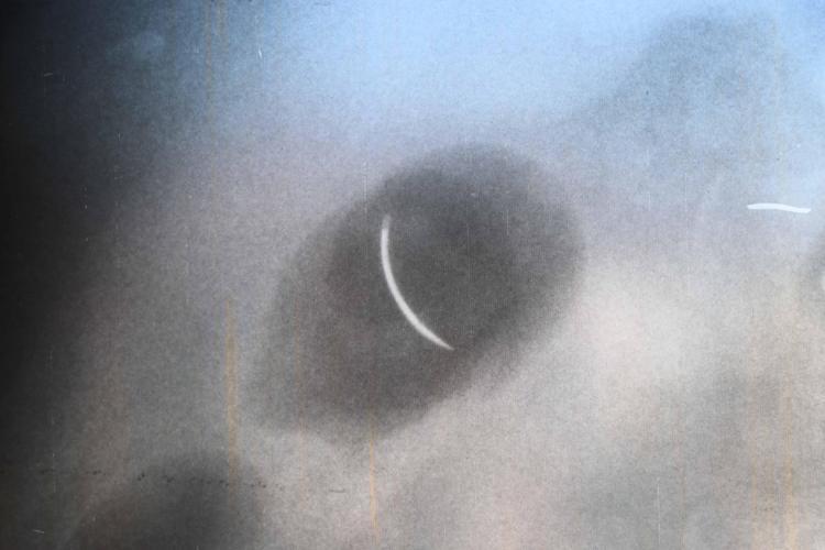 YAŞAYAN ÖLÜ GİBİYİM