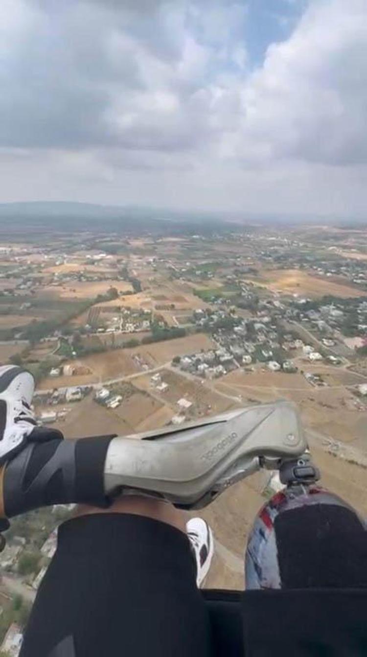 PROTEZLE SAHNE ALMAK İSTERİM