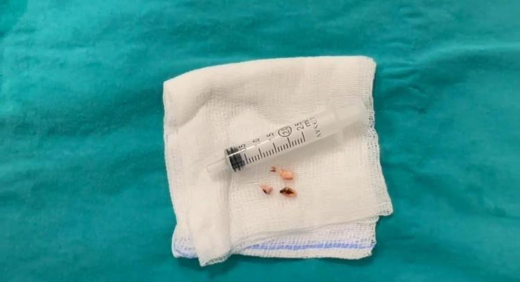 ‘HASTAMIZIN GENEL DURUMU İYİ’