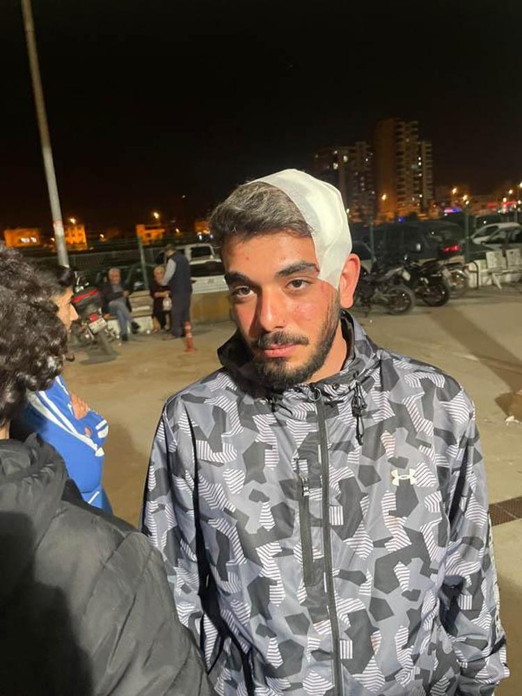 VİDEOYU SANKİ BİZ SALDIRMIŞIZ GİBİ PAYLAŞTI