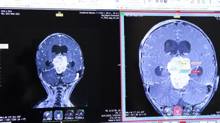 ‘GENETİK VE MOLEKÜLER ANALİZ SONUÇLARI DOĞRULTUSUNDA TEDAVİ PLANLAMASI YAPILDI’