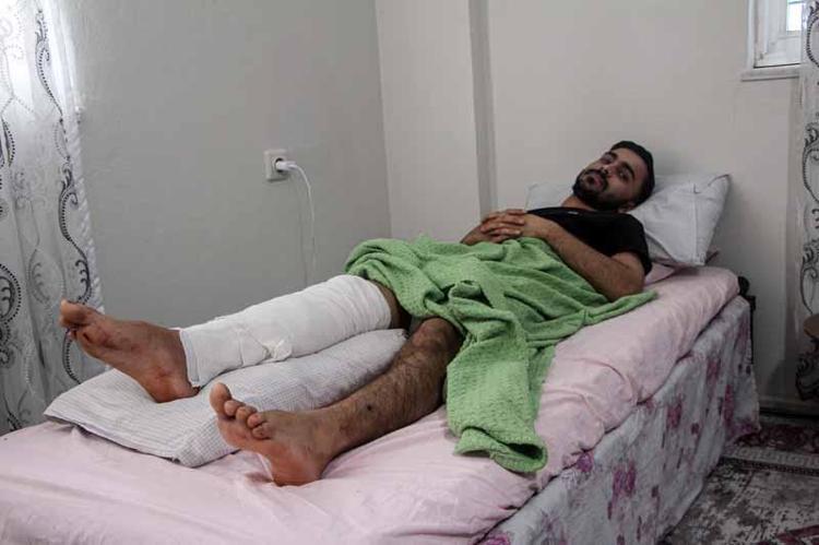 ‘BACAĞIMDAKİ KEMİKLER PARAMPARÇA OLDU’