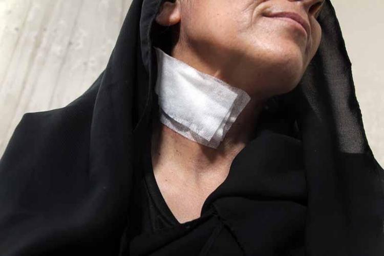 ‘KARNIMDAN VURULUNCA ÖLECEĞİMİ HİSSETTİM’