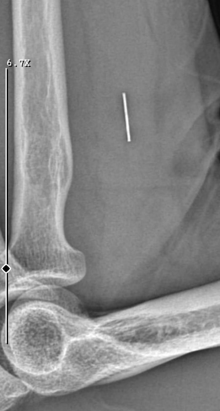 ‘RÖNTGEN VE MR ÇEKİLMEDİ’
