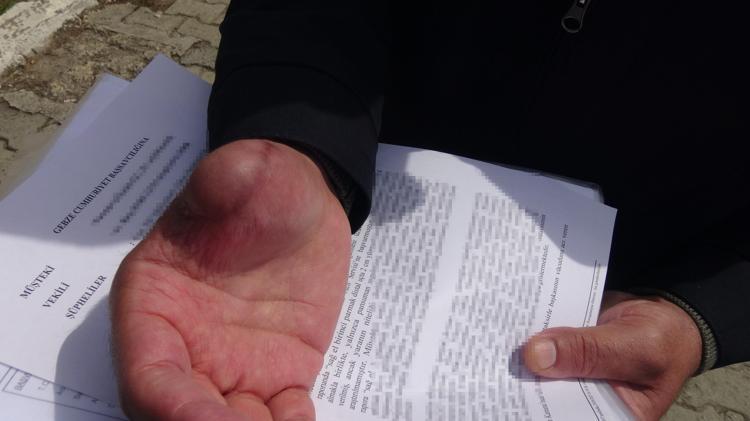 ‘PARMAĞIM ÇÜRÜMEYE BAŞLADI’