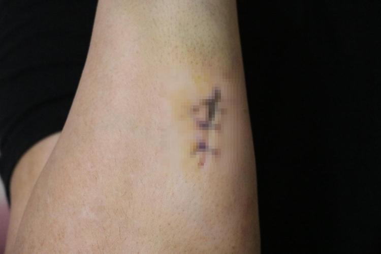 ‘YARALI HALDE HASTANEYE GİTTİM’