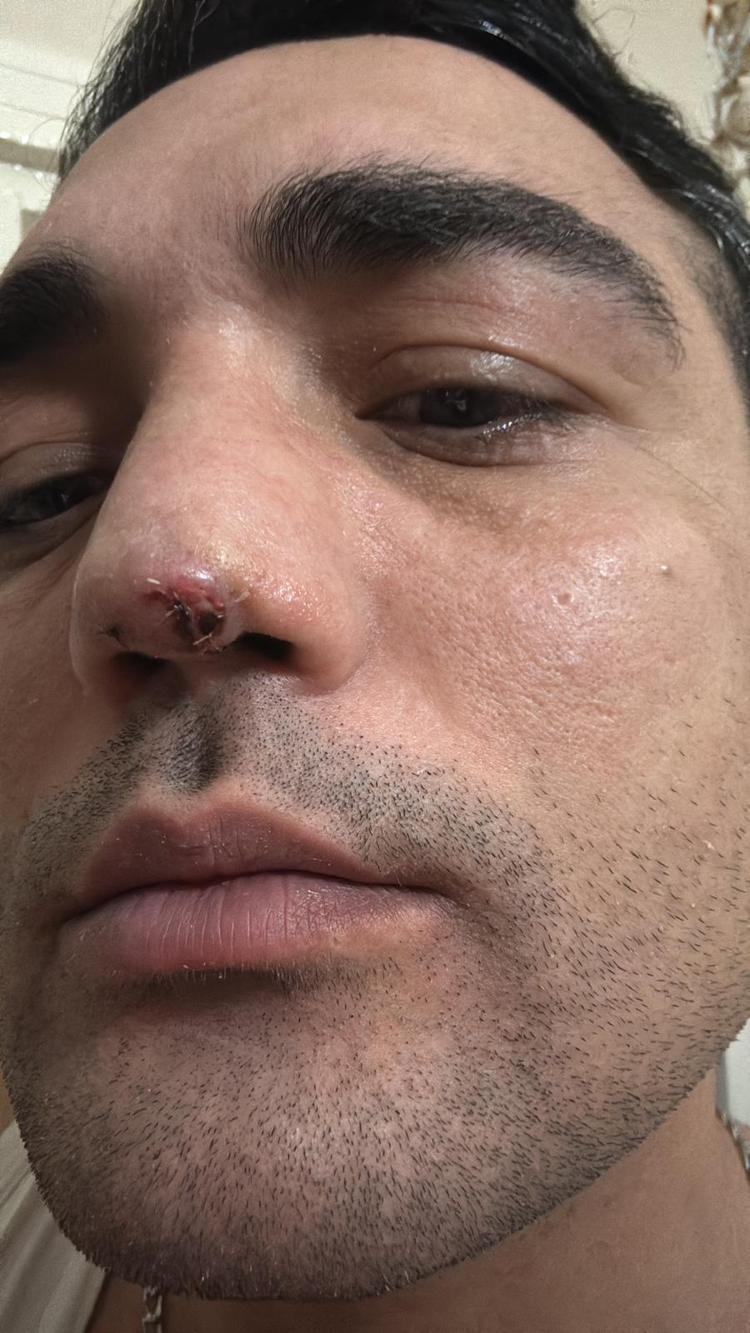 KIKIRDAK EKLENDİ; 3 AY SONRA O KIKIRDAK DA ERİDİ