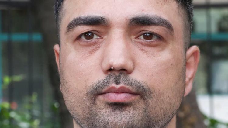 BURNUMUN DÜZELMESİ İÇİN KAÇ KERE AMELİYAT OLMAM GEREKİYOR