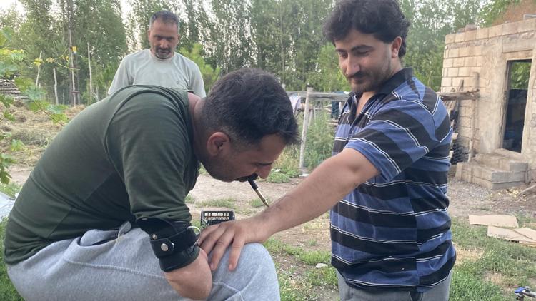 ZATEN İKİ KOLUNU KAYBETTİ, BARİ BACAĞI KALSIN DEDİM