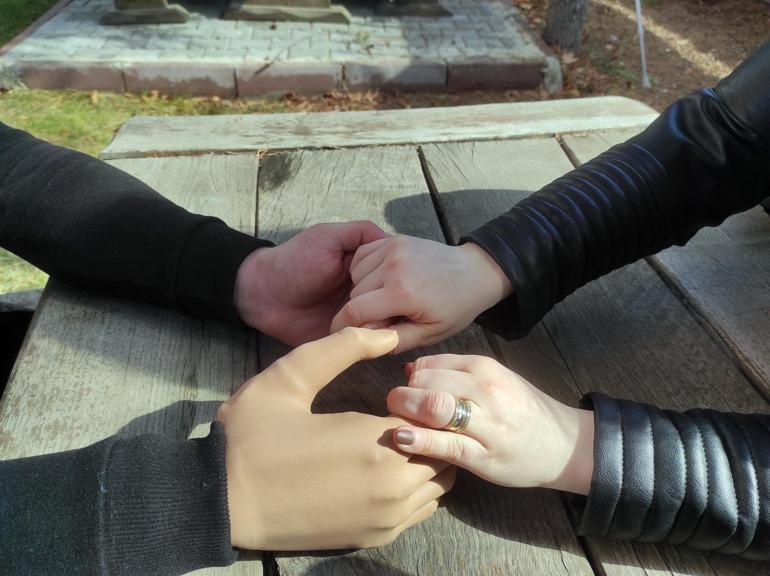 Pençe-Şimşek gazisine biyonik kol takıldı