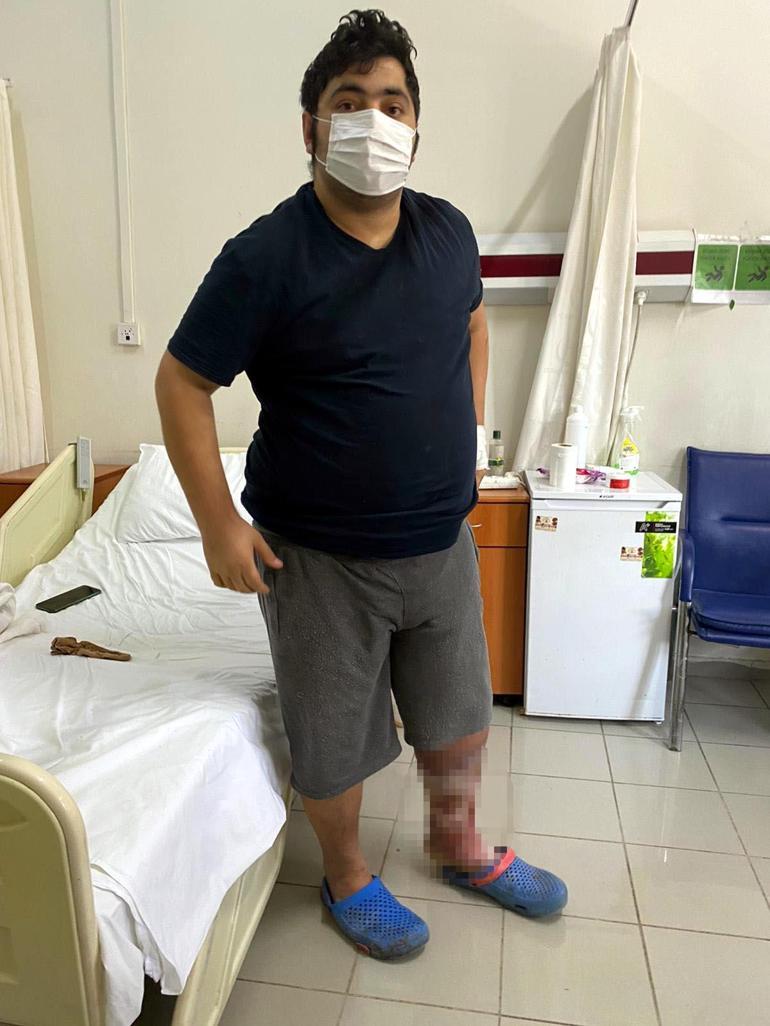 Venöz ülser hastası, ilaç tedavisiyle bacağını kaybetme riskinden kurtuldu