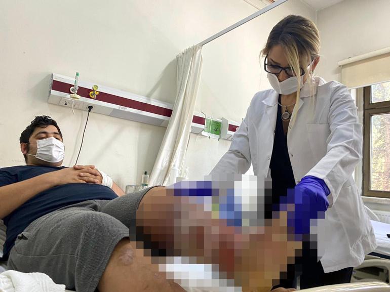 Venöz ülser hastası, ilaç tedavisiyle bacağını kaybetme riskinden kurtuldu